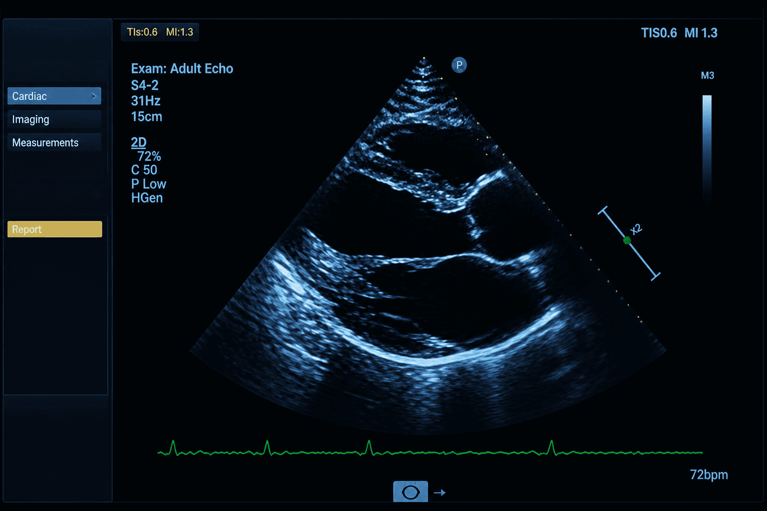 Echocardiogram study open in the MedIQ viewer