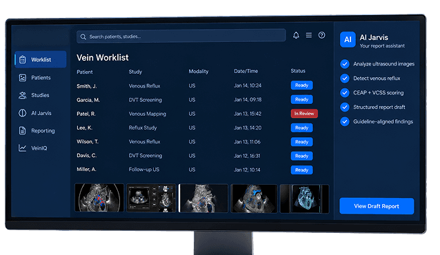 SARC MedIQ Vein Worklist dashboard with the AI Jarvis report assistant