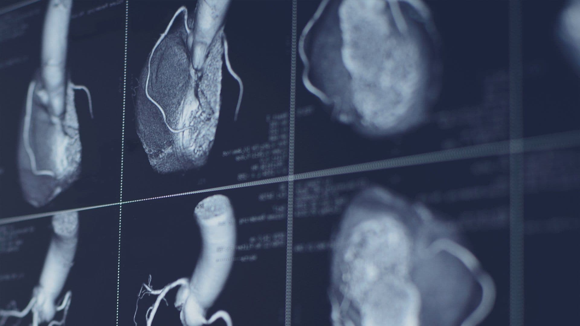 The Evolution of Cardiac Imaging: How AI, Portability, and Ultra-Resolution Are Transforming Heart Diagnostics