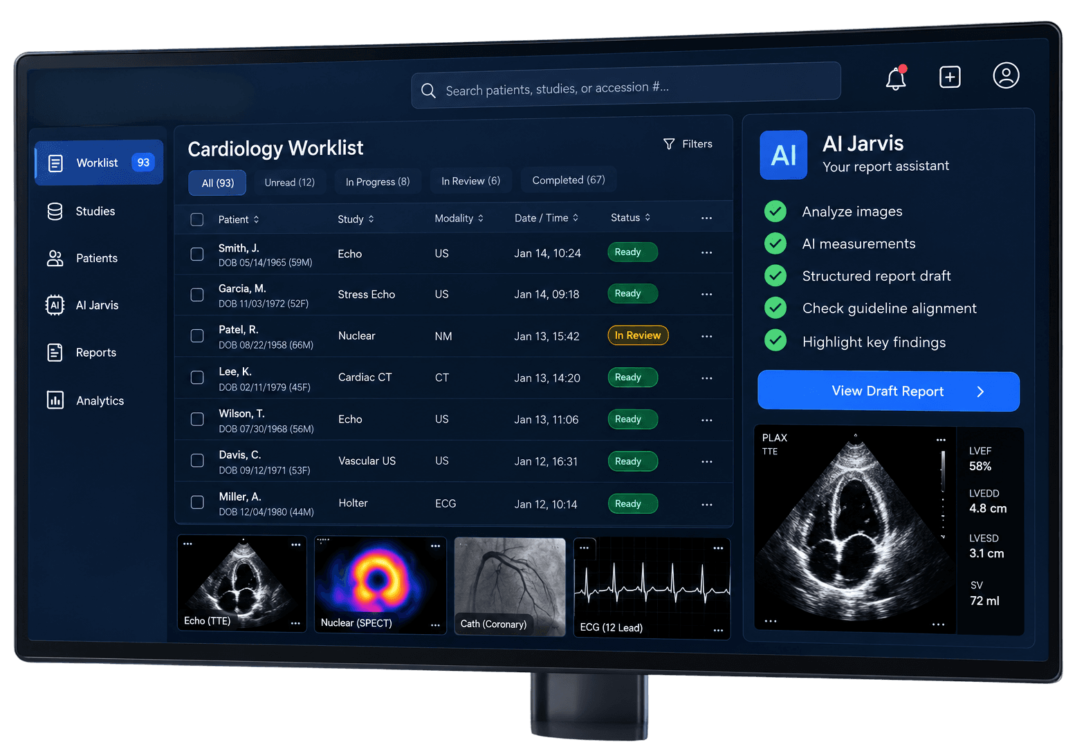 SARC MedIQ Cardiology Worklist dashboard with the AI Jarvis report assistant