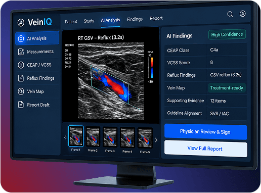 VeinIQ AI Analysis worklist dashboard with CEAP/VCSS scoring and reflux findings